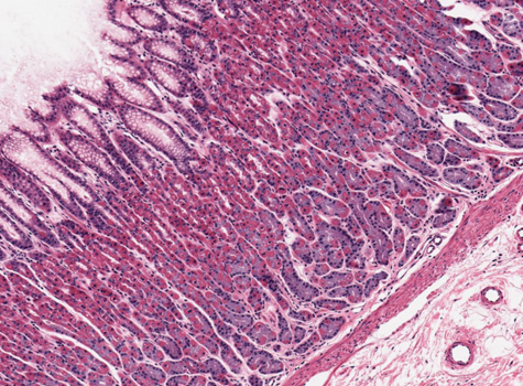 well-preserved aliquot of normal gastric mucosa